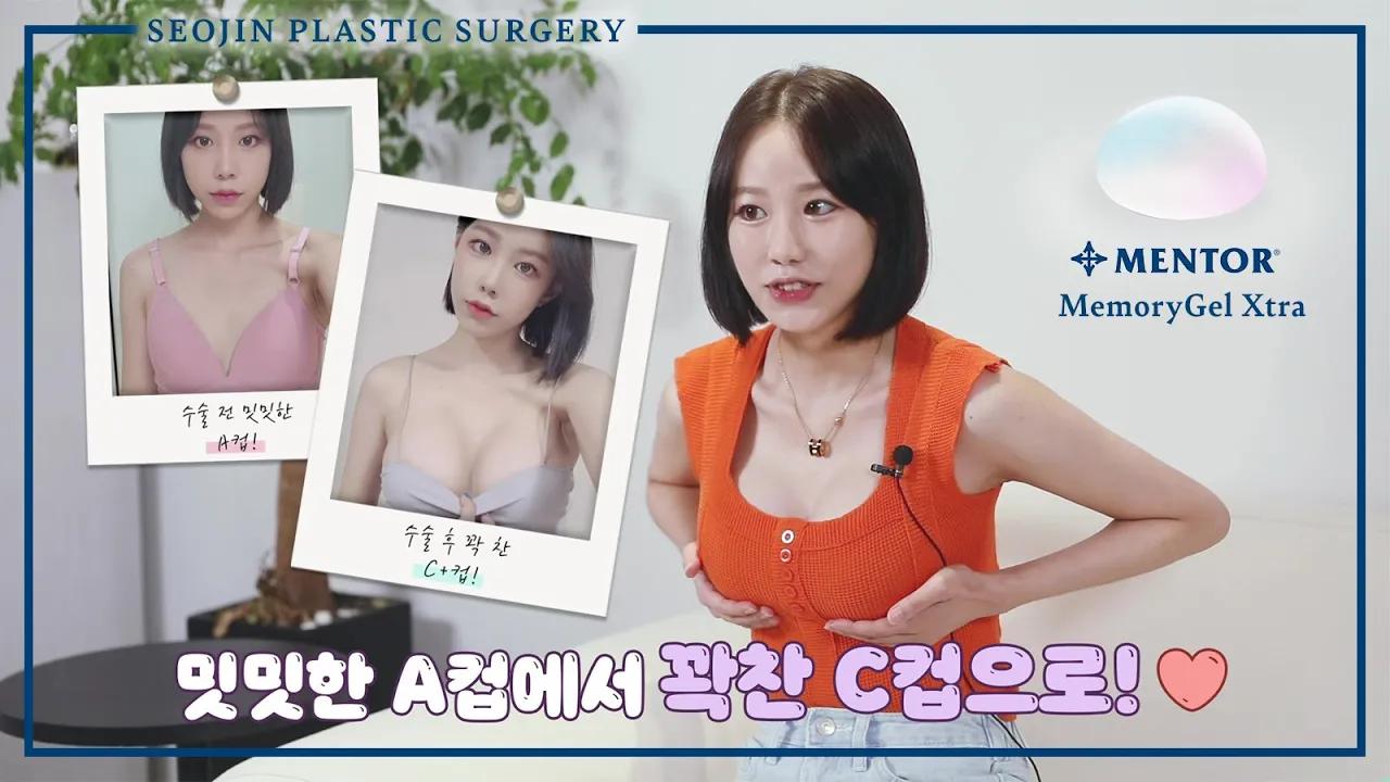 My Mentor Breast Implant Experience at Seojin Clinic in Korea (Review)