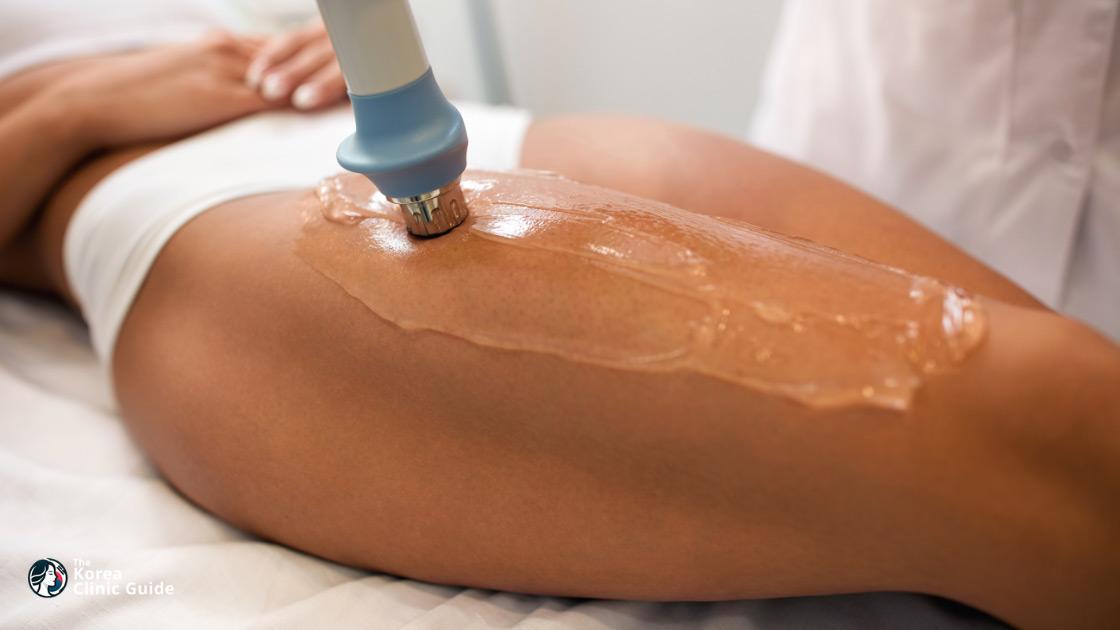 Shockwave Therapy for Fat Dissolving in Korea | Best Clinics, Costs, Procedure Types & More