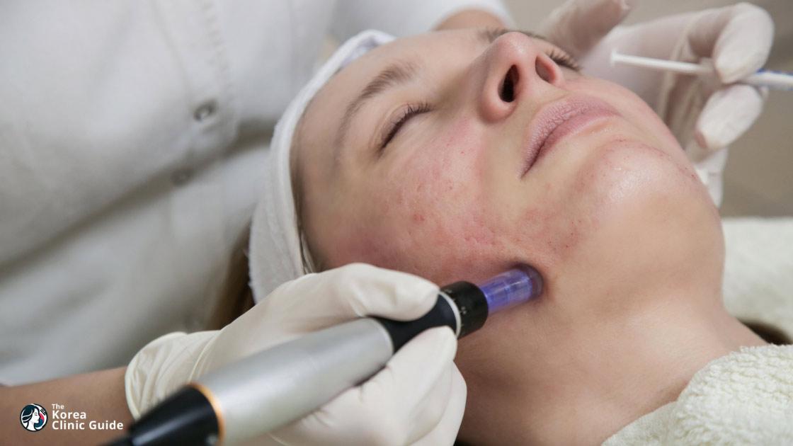 Non-surgical Skin Tightening