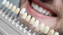 Veneers in Korea | Best Clinics, Cost of Veneers and More