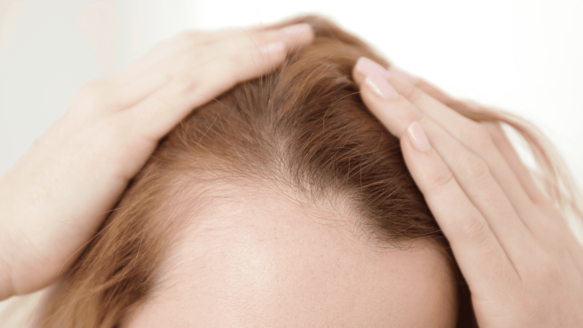 Hairline Lowering Surgery in Korea: Costs, Clinics, and Procedures Explained