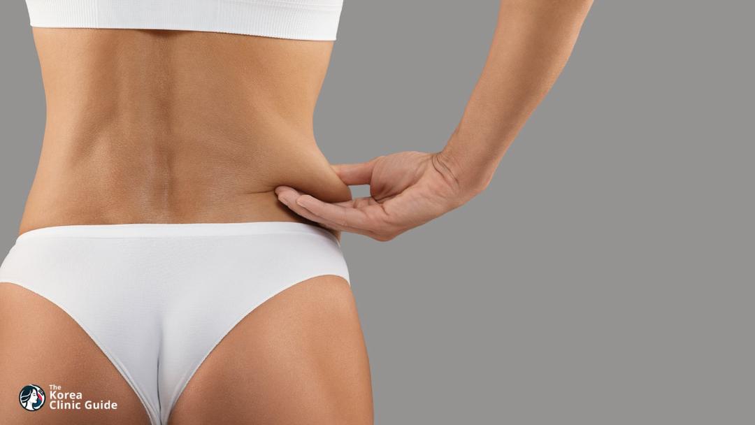 waist liposuction