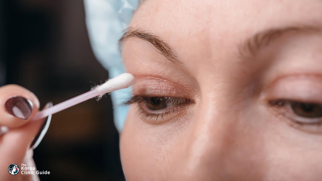 eyelid fat grafting