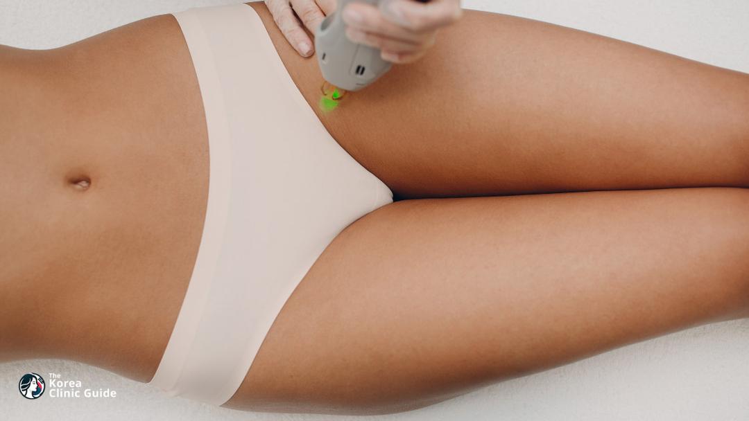 brazillian laser hair removal