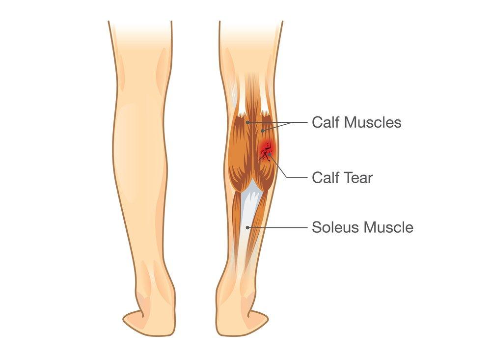 calf reduction surgery korea