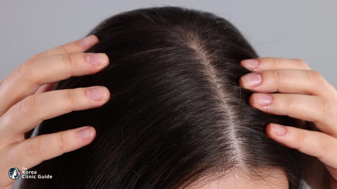 Stem Cell Scalp Therapy in Korea | Best Clinics, Costs, Procedure Types & More