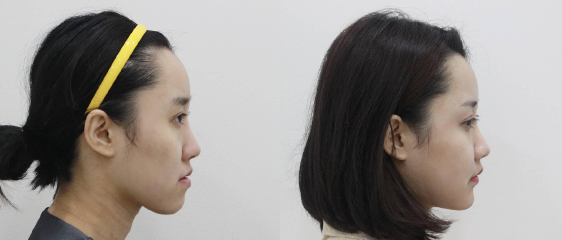 Ilumi Plastic Surgery Clinic4