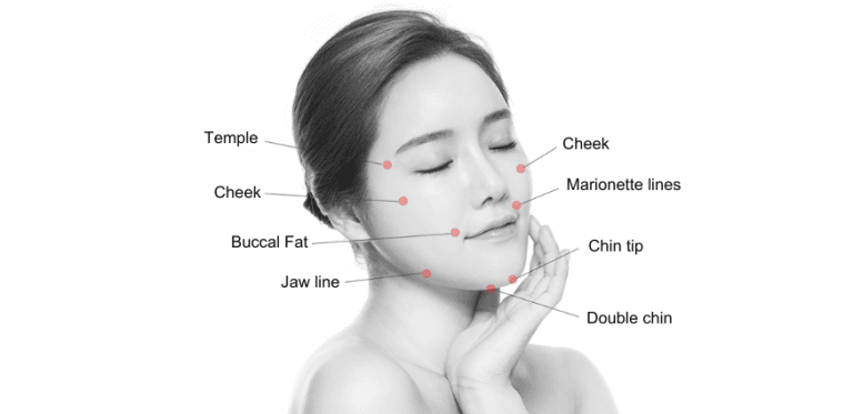 sagging after facial liposuction korea