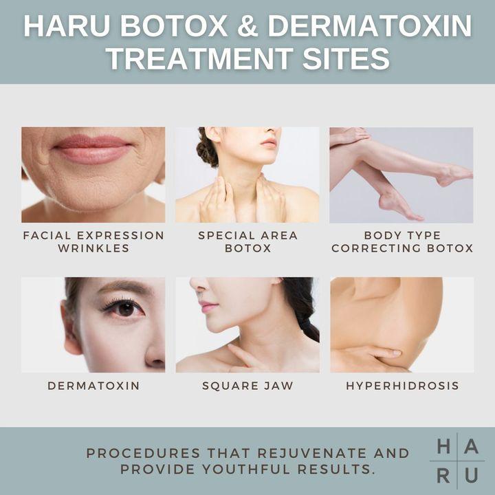 cost facial botox korea