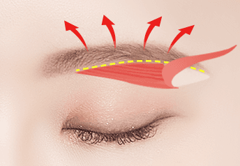 cost eyebrow lift korea