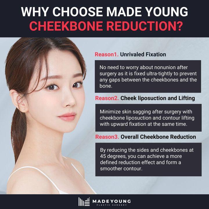 cost cheekbone reduction korea