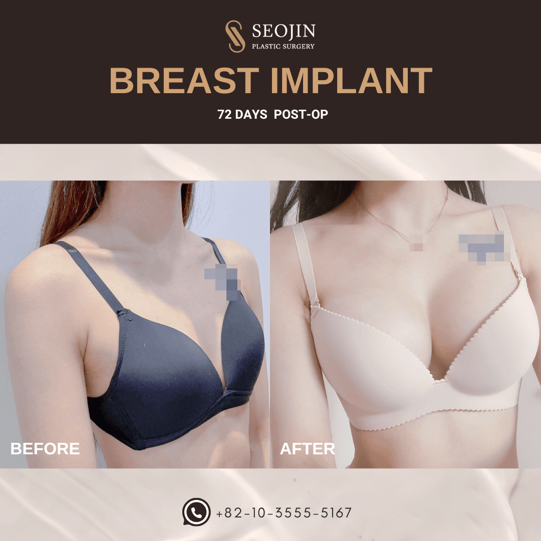 cost breast surgery korea