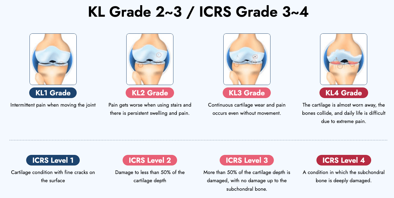 stem cells for knee cartilage regeneration korea