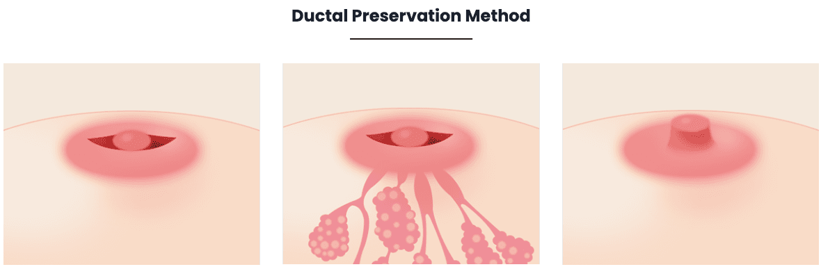 how to fix inverted nipples korea