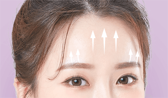 forehead lift korea