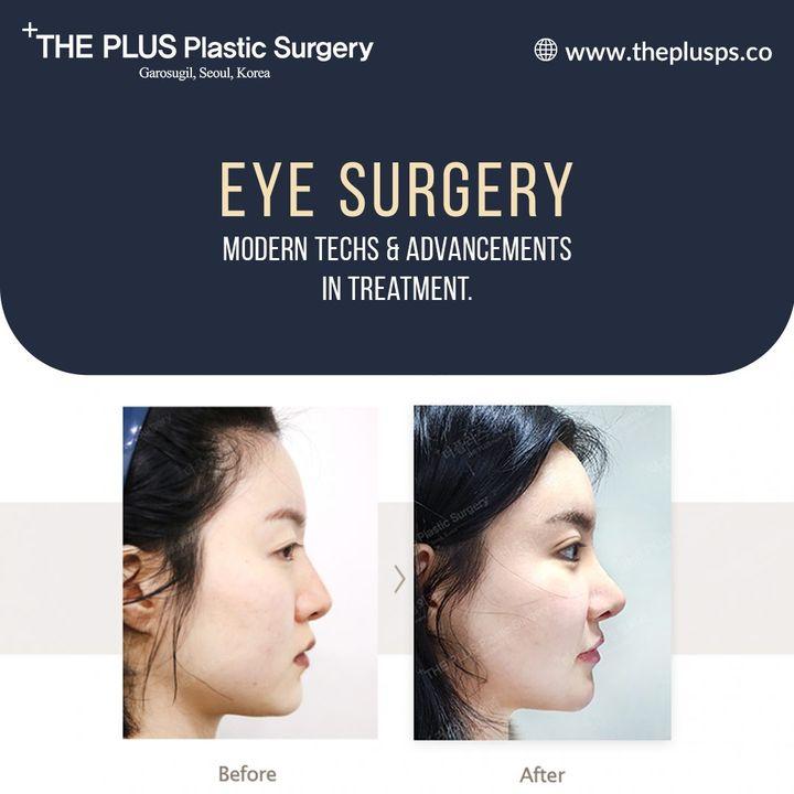 cost blepharoplasty korea