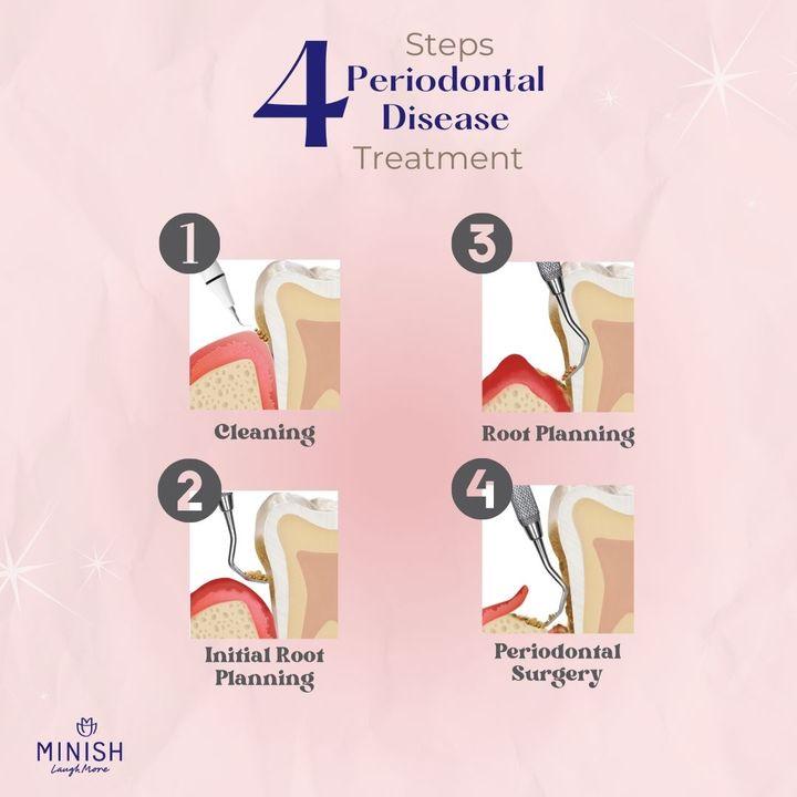 periodontal disease treatment korea