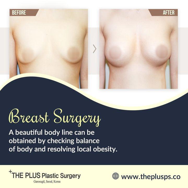 breast surgery korea