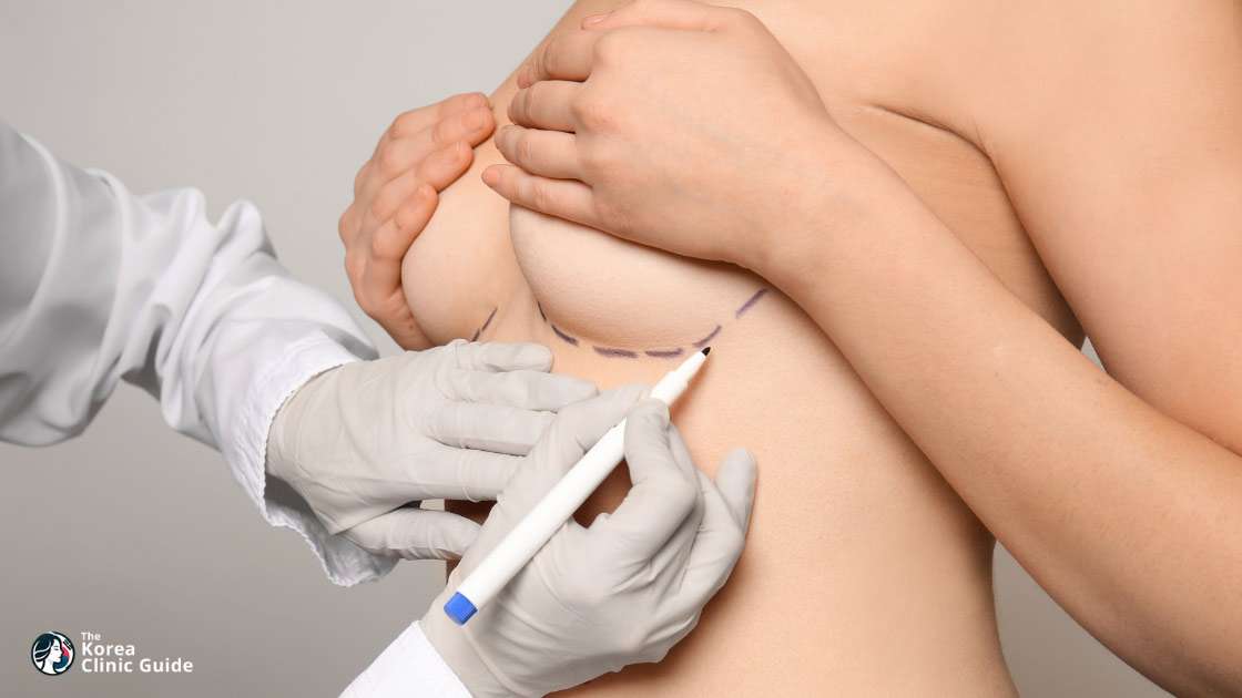 Breast Surgery in Korea: Types, Recovery, Travel Planning, and Safety
