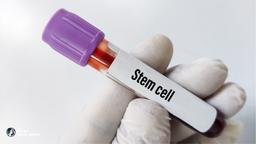Stem Cell Fat Grafting in Korea: Methods, Safety, Recovery, and Travel Planning