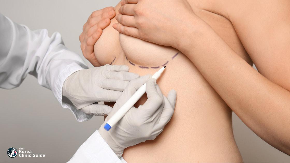 Breast Fat Grafting in Korea: Candidacy, Recovery, Results, and Travel Planning