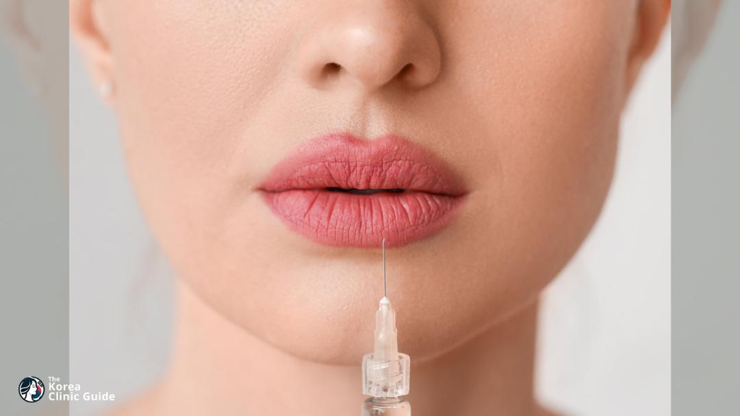 lip fillers
