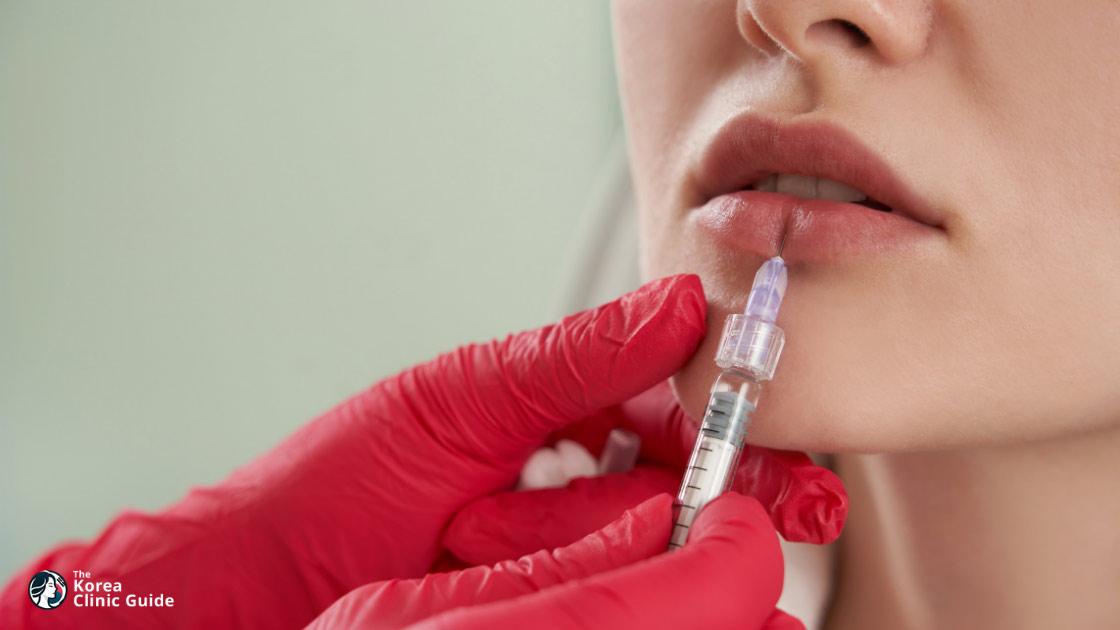 Lip Augmentation in Korea: Methods, Safety, Recovery, and Travel Planning