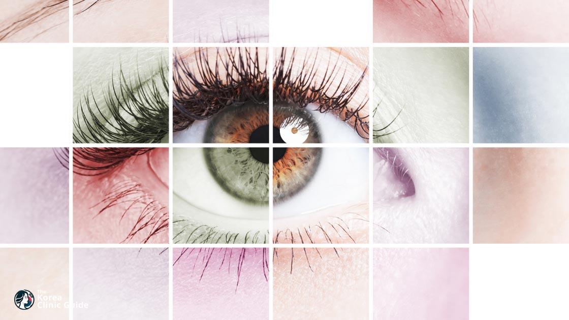 Cataract Surgery in Korea: IOL Options, Recovery, Travel Planning, and Safety