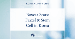 Boxcar Acne Scars: Fraxel Laser and Stem Cell Acne Scar Procedures in Korea