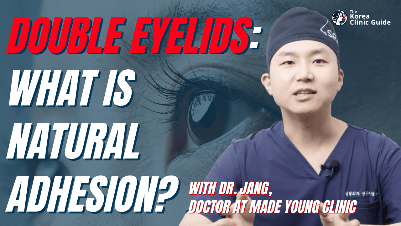 Double Eyelid Surgery: What is Natural Adhesion, and Why is it Popular? with Dr. Park from MadeYoung