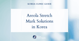 Areola Stretch Marks Solutions: Areola Surgery Options in Korea for Effective Scar Treatment