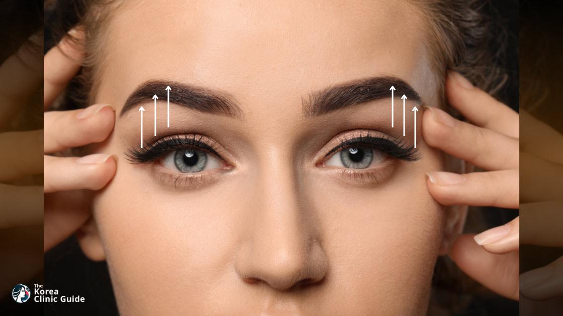 Eyebrow Lift in Korea | Costs, Procedure Types, Candidacy & Recovery