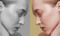 Revision Rhinoplasty in Korea | Best Clinics, Costs, Procedure Types & More