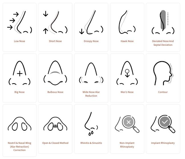 Rhinoplastik