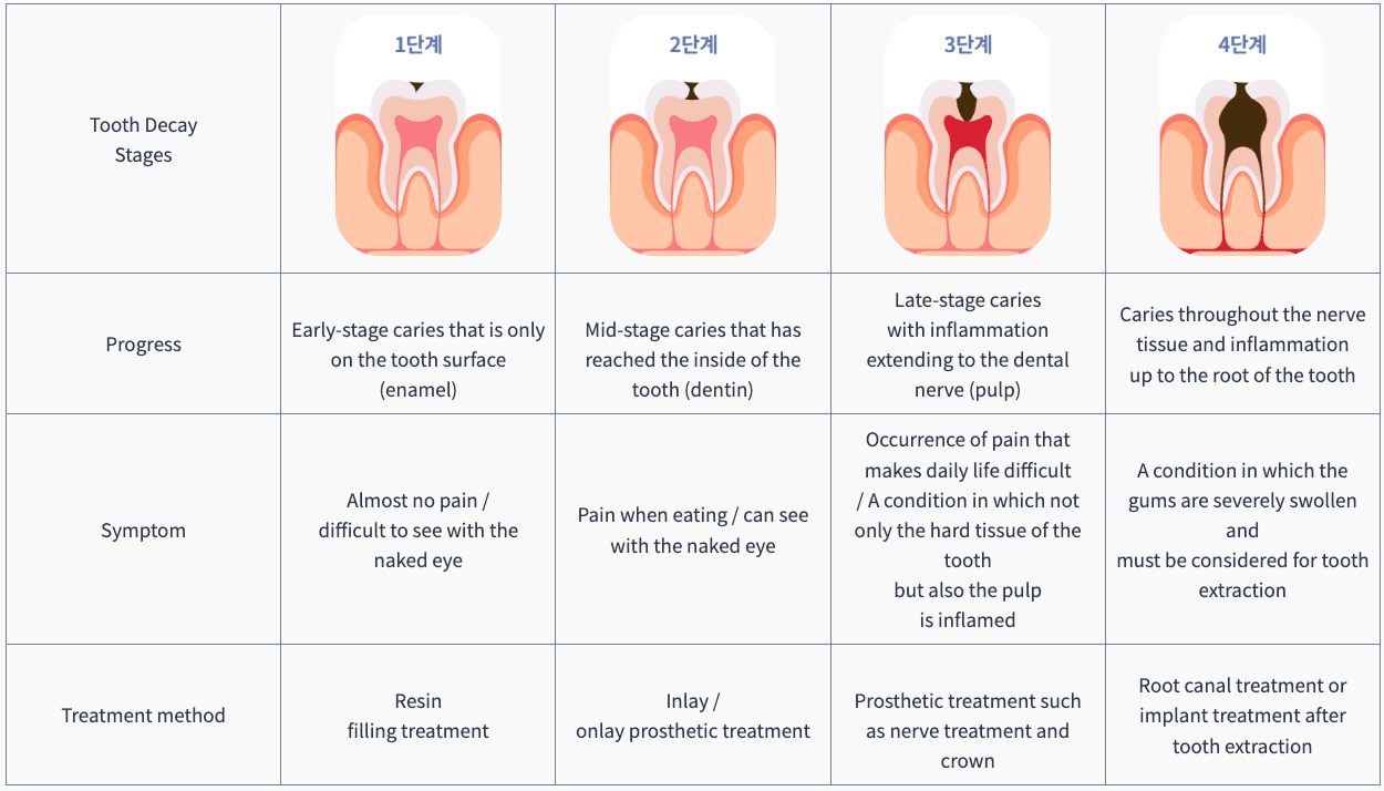 Inlay Filling, Resin Filling, Teeth Crown