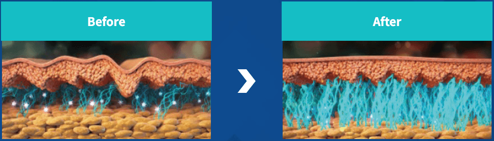 Collagen injection, Collagen Booster