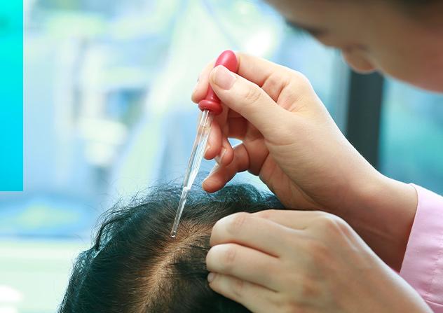 Scalp Care, Hair Loss Treatment