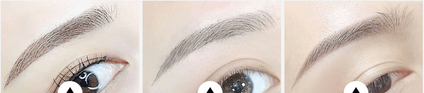 Three Wishes Clinic - Myeongdong before and after image