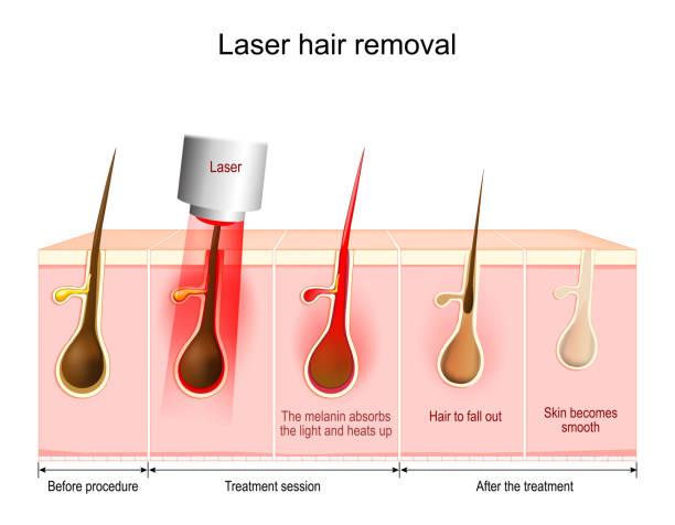 Leg Laser Hair Removal, Arm Laser Hair Removal, Body Laser Hair Removal, Chest Laser Hair Removal, Facial Laser Hair Removal, GentleMax Pro Hair Removal, Hairline Laser Hair Removal, Underarm Laser Hair Removal, Upper Lip Laser Hair Removal, Abdominal Laser Hair Removal, Brazillian Laser Hair Removal