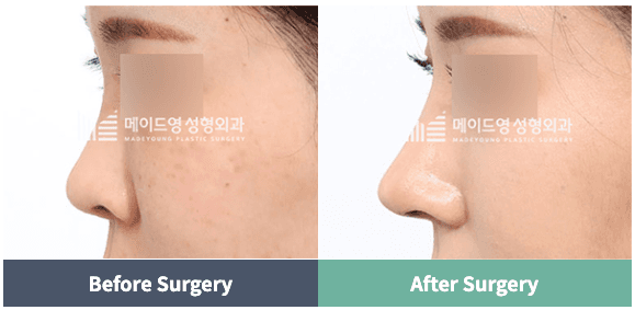 Made Young Plastic Surgery before and after image