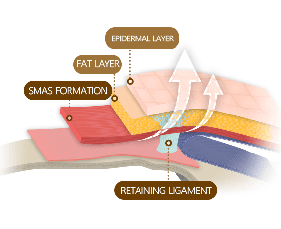 Face Lift, Neck Lift, SMAS Facelift