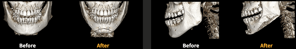 Made Young Plastic Surgery before and after image
