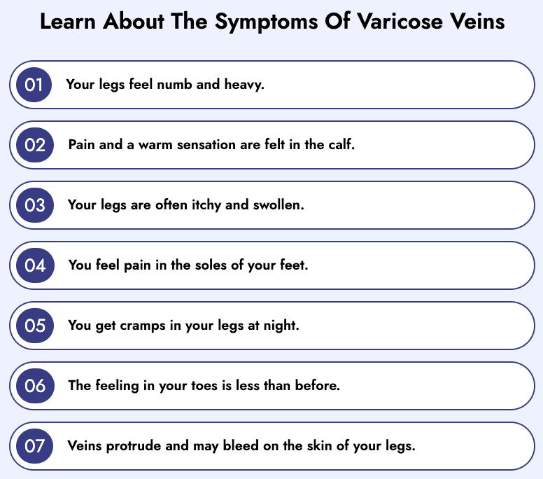 Varicose Vein Treatment