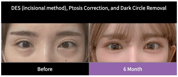 Made Young Plastic Surgery before and after image