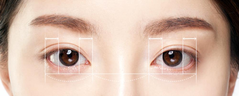 Canthoplasty, Laser Canthoplasty