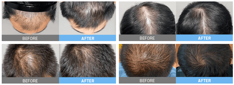 Lydian Plastic Surgery Clinic before and after image