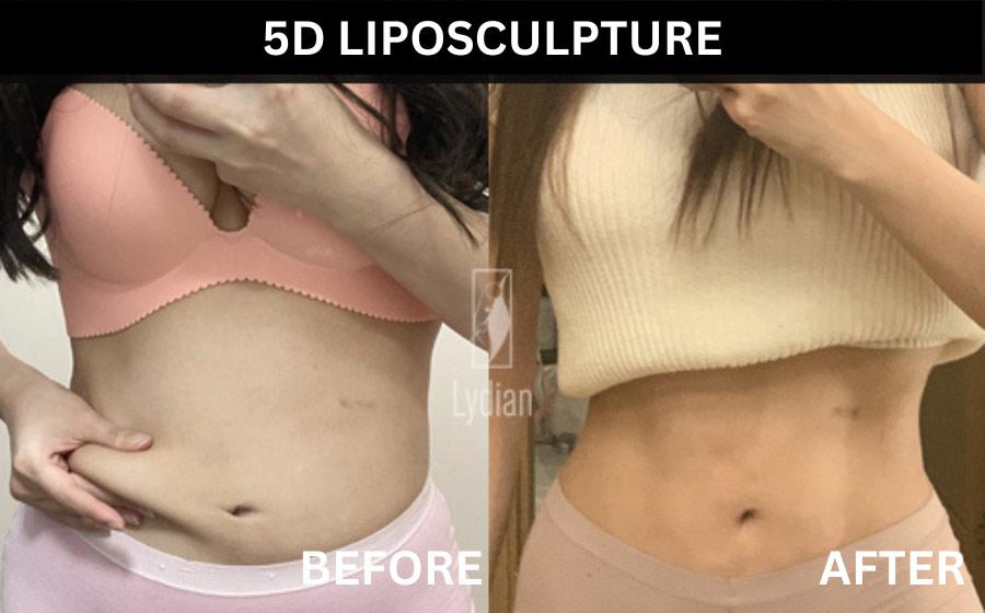 Lydian Plastic Surgery Clinic before and after image
