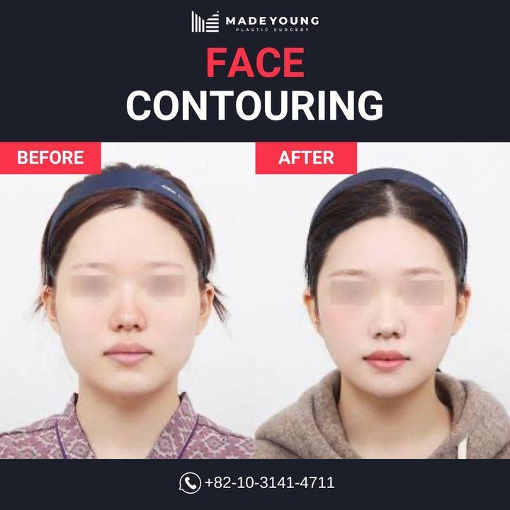 Define your beauty with face contouring at Made Young. Our transformations showcase the skill and artistry that help achieve your desired look.